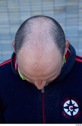 Head Hair Man White Casual Average Bald Street photo references